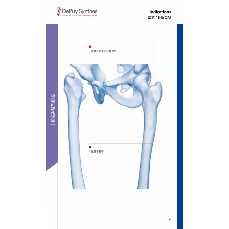 股骨近端和股骨干 1