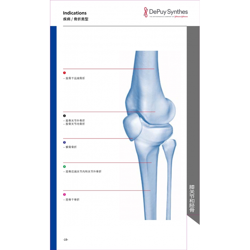 膝关节和胫骨 1